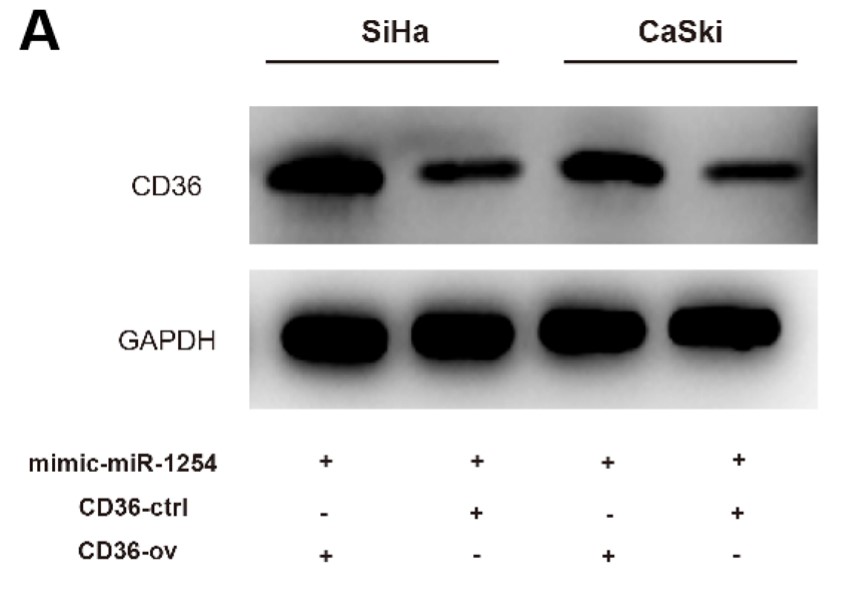 CD36 overexpression rescued the effects of miR-1254 on the cervical cancer cells.jpg